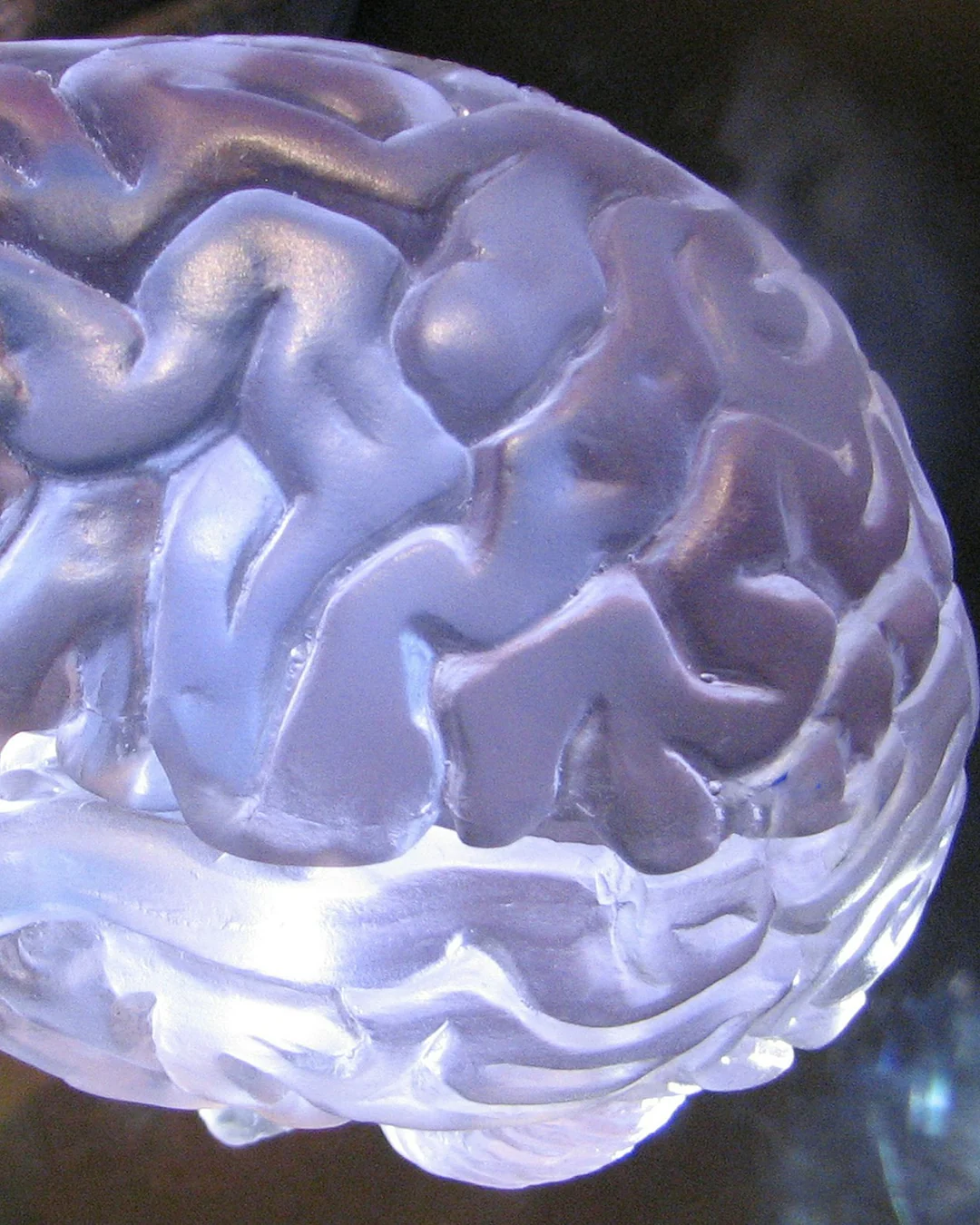 Epilepsiya